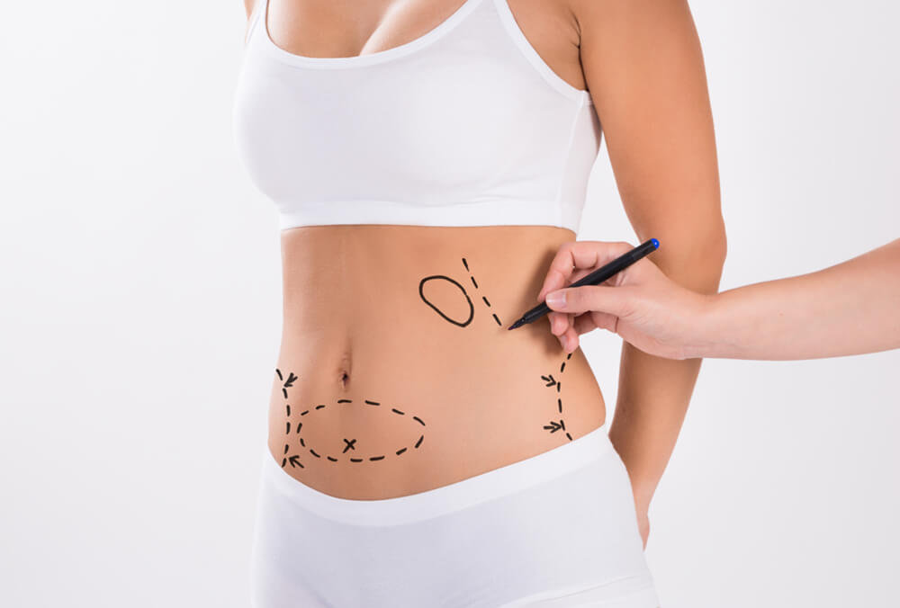 How Liposuction in Dubai Can Affect Your Psychological Well-being